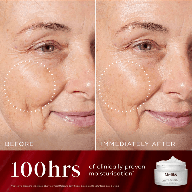 Medik8 Radiance Wrapped Gift Set - Bare Face Beauty